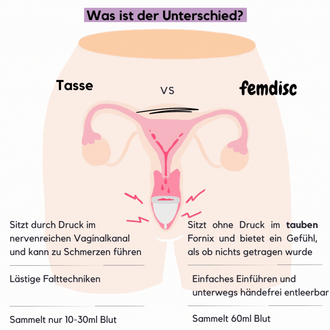 femdisc Einwegscheiben 10-Pack - Image 10