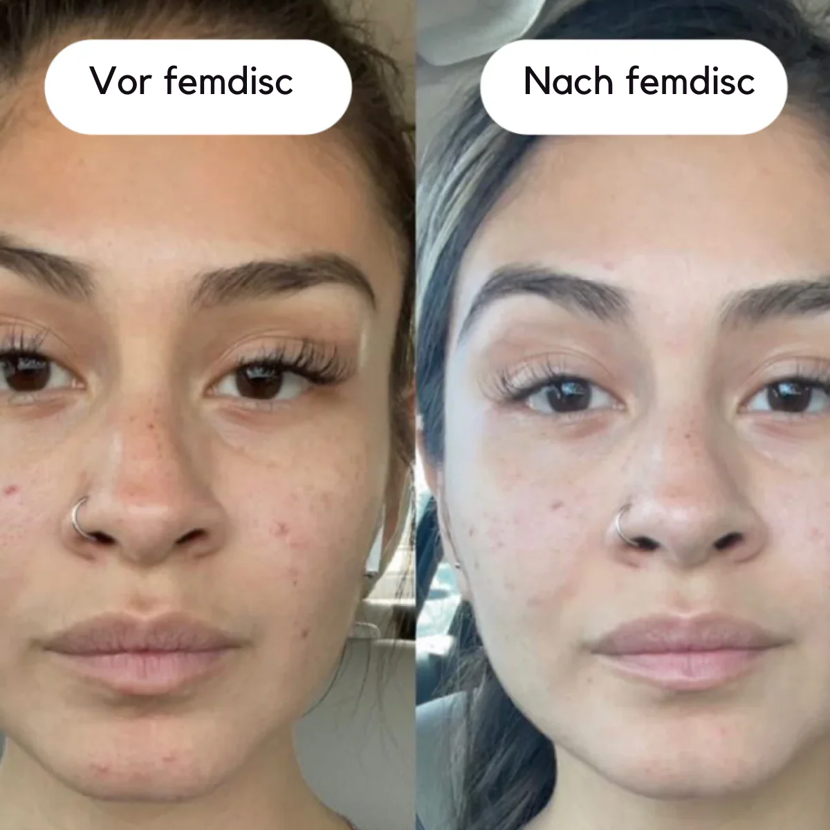 femdisc Pms Gummies - Image 5